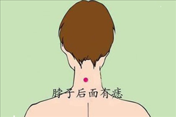 苦情痣头婚必离婚 苦情痣预示头婚必离婚真相揭秘与化解方法