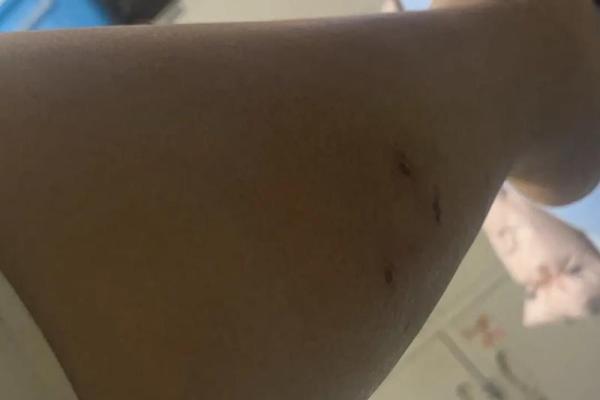 梦到被猫咬
