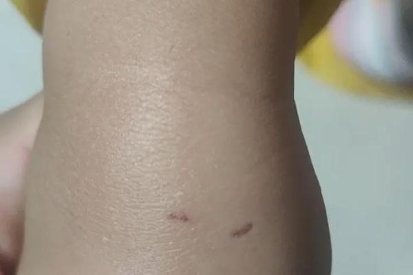 梦到被猫咬是什么征兆 男性