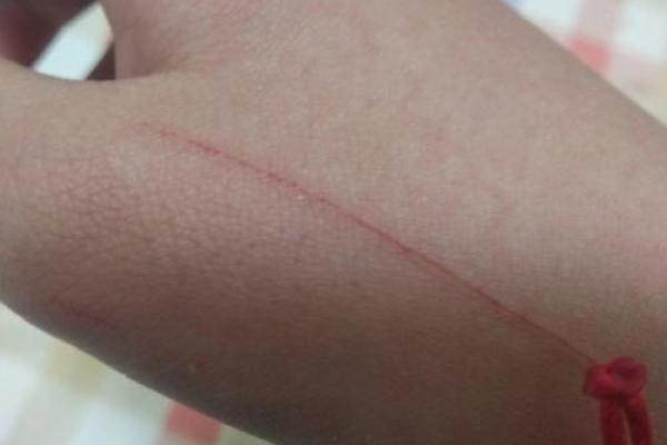 梦到被猫抓