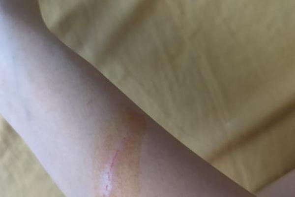 梦见被猫抓了